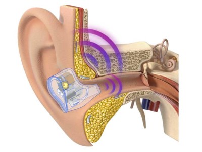 BGVP Phantom BCD Implementation 2